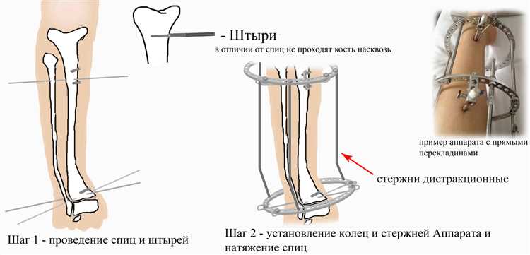 Ограничения