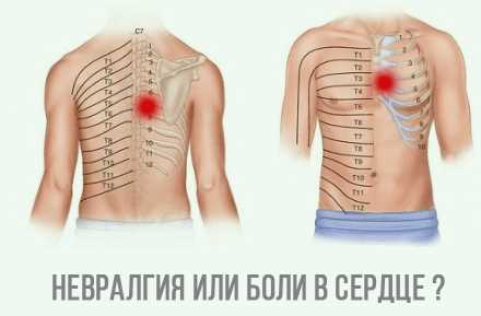Воздействие