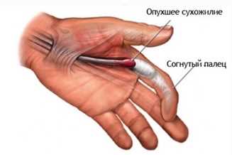 Механические