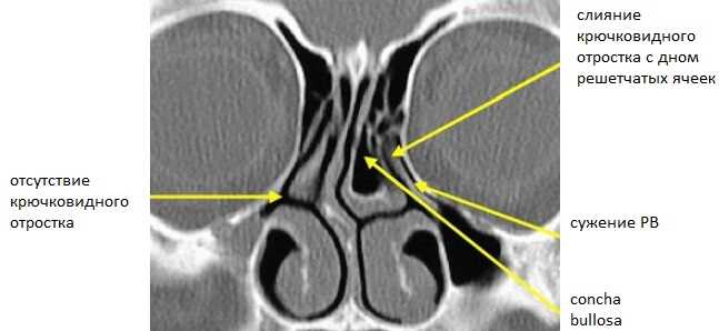 Профилактика