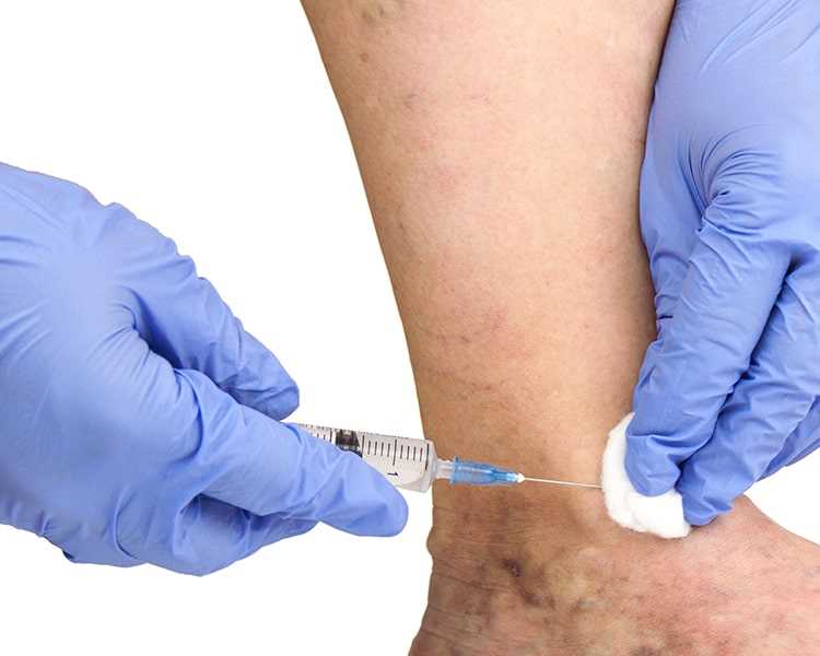 Использование