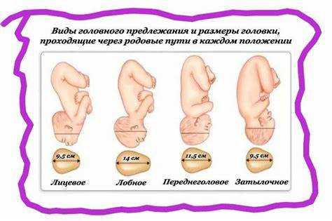 Психологические аспекты родов с головным предлежанием