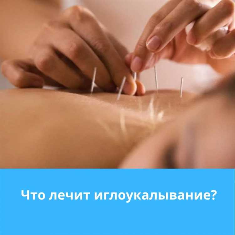 Преимущества