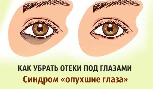 Массаж области вокруг глаз: техники и советы