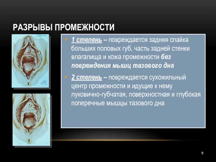 Нормальные