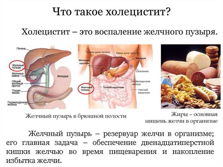 Истории успешного избавления от проблем с желчными путями