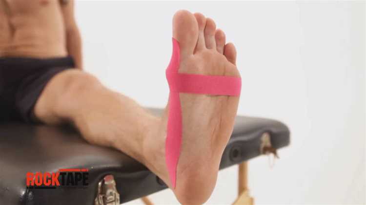 Распознавание