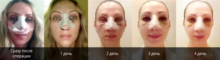 Естественные