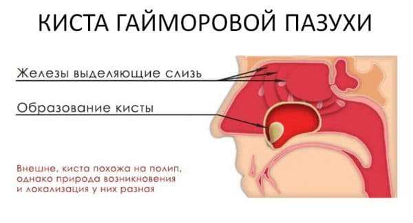Присваивание
