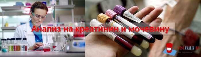 Факторы, влияющие на уровень креатинина в организме