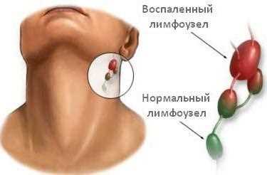 Профилактика