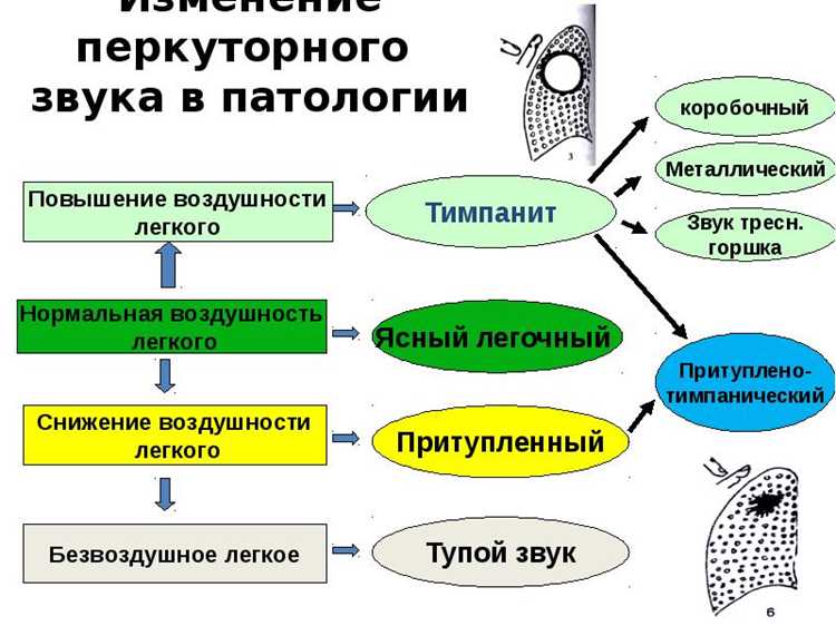 Оценка перкуссионного звука: нормы и патологии