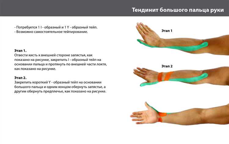 Диагностика