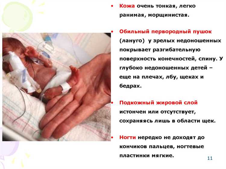 Реабилитация и уход за детьми с нарушениями центральной нервной системы