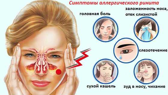 Симптомы