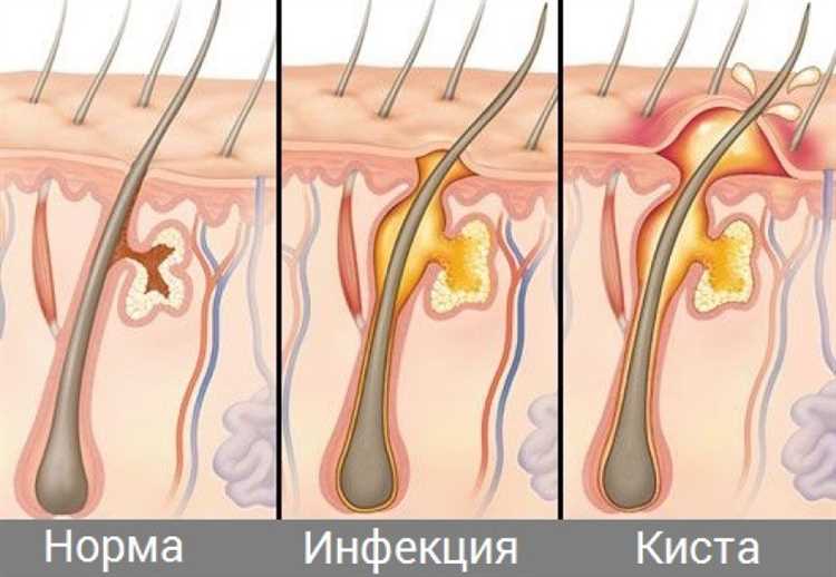 Опасности