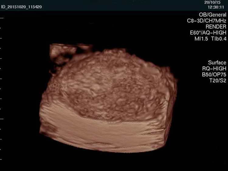 Значимость