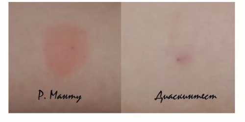 Недостатки