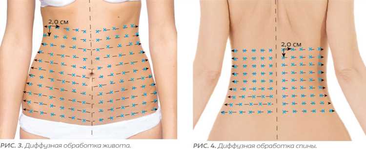 Анатомическая