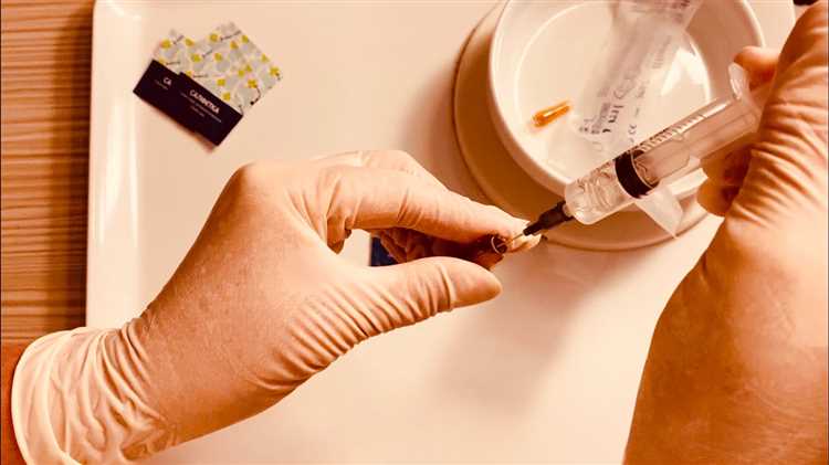 Особенности